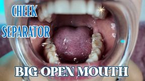 CHEEK SEPARATOR BIG OPEN MOUTH