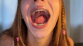 Mango review and burps