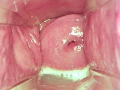 Huge creampie reward for teen vixen after hardcore fucking