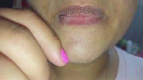 Mordidas y marcas en el dedo