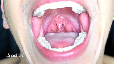 Large uvula and hot