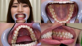 Natuki Takeuchi - Watching Inside mouth of Japanese cute girl - MOV 1080p