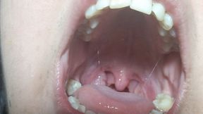 Uvula in close-up