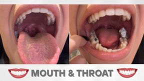 Mouth and throat fetish Open mouth Uvula movement