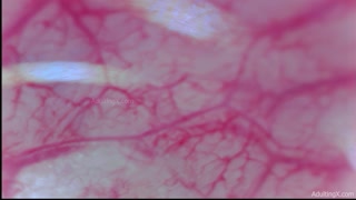 Camera Inside Ass, 9 Throbbing Pulsing Anal Orgasms,  Live Stethoscope Heartbeat - Full Clip