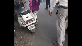 Polio affected weak legs disabled woman