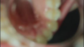 Oral examination with a cosmetic mirror