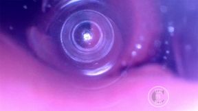 Endoscope Journey into My Deepest Intestines