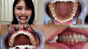 Mikana Mii - Watching Inside mouth of Japanese cute girl - MOV