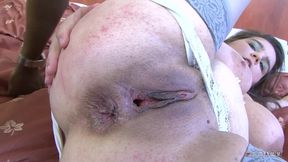 Chubby girl has a perfect big tits for a proper boob job