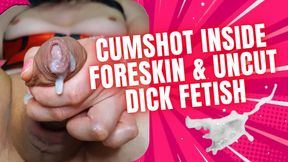 Cumshot Inside Foreskin &amp; Uncut Dick Fetish