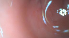 Anal endoscope