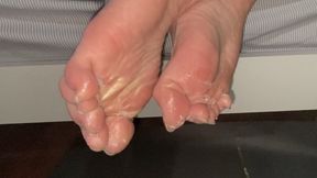 Bare toes stuck fast with superglue