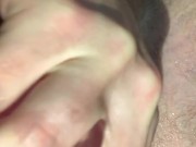ANAL SPECULUM