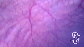 Look inside my Bladder as I push a Torch up my Ass