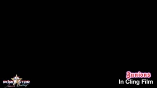 Bunions in CLING FILM