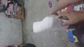 PE WITH PLASTER SPLINT