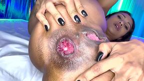 flexi milf prolapse her destroyed anus