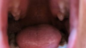 ORAL EXAMINATION | Jasmine