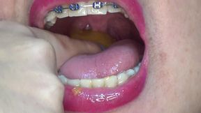 I Swallowed Huge Chunks of Peach