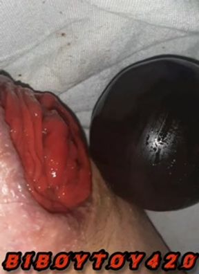 Huge extreme Anal gaping 3" black ball insertion and huge anal prolapse.hot anal compilation #1 2024
