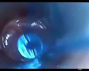 Endoscope POV: Test Tube Cock Urethral Insertion