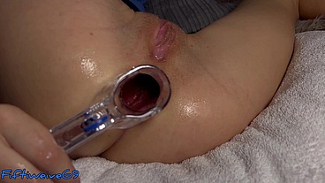 Anal dilator play, look deeper inside her