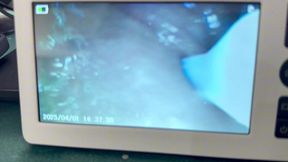 girls explore their holes with endoscope