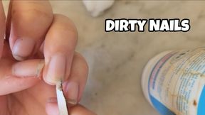 Removing Nail Polish & Cleaning Under My Nails – Close-Up Manicure Removal