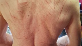 painful scratch with very long naturals, t marks my slve with my big L C4SWrestling26