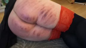 Layering bruises after a caning session 4 days ago