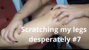 Scratching my legs desperately. #7