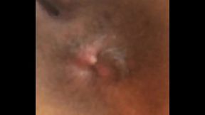 Cuzinho da coroa de Cachoeiro de Itapemirim