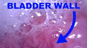 INSIDE POV: Inflating my Bladder with Air!