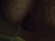 4k pee post op