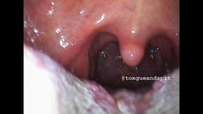 William Mouth Endoscope Part19 Video2 NO AUDIO - MP4