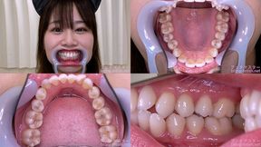 Michi Kitamura - Watching Inside mouth of Japanese cute girl - MOV