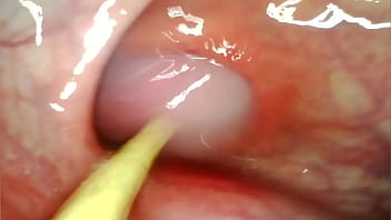 ANAL POV. CAMERA INSIDE HER ASSHOLE AS I POUND HER WITH MY BIG COCK AND CUM DEEP INSIDE