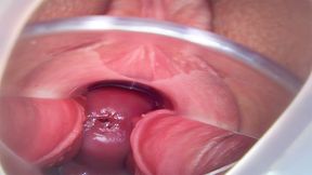 4 Orgasms with Speculum Cervix View