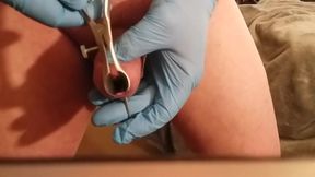 First Transurethral With 10ga Needle