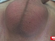 Scrotum with eggs moves fast