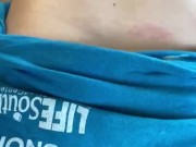 Tummy slaps