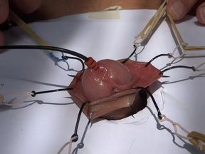 fishhooks in foreskin