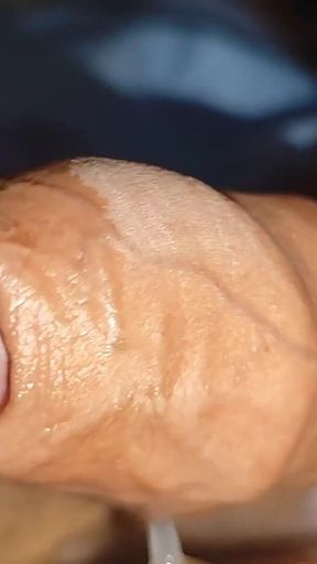 Stepdaddy Opens His Phimosis and Gets a Big Load.