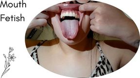 Drooling, an open mouth, and crooked teeth..