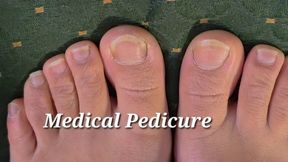 Medical pedicure for small feet