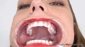 Inside My Mouth - Maria - Mouth retractor time! (4K quality)