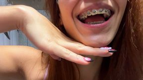 Cleaning the braces