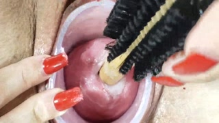 dilating my cervix up close