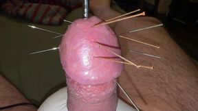 Acupuncture - Orgasm!